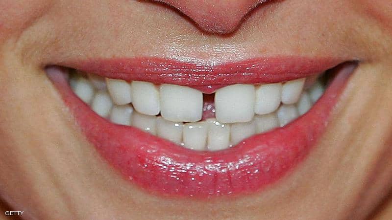 10 طرق طبيعية لا غنى عنها لتبييض الأسنان